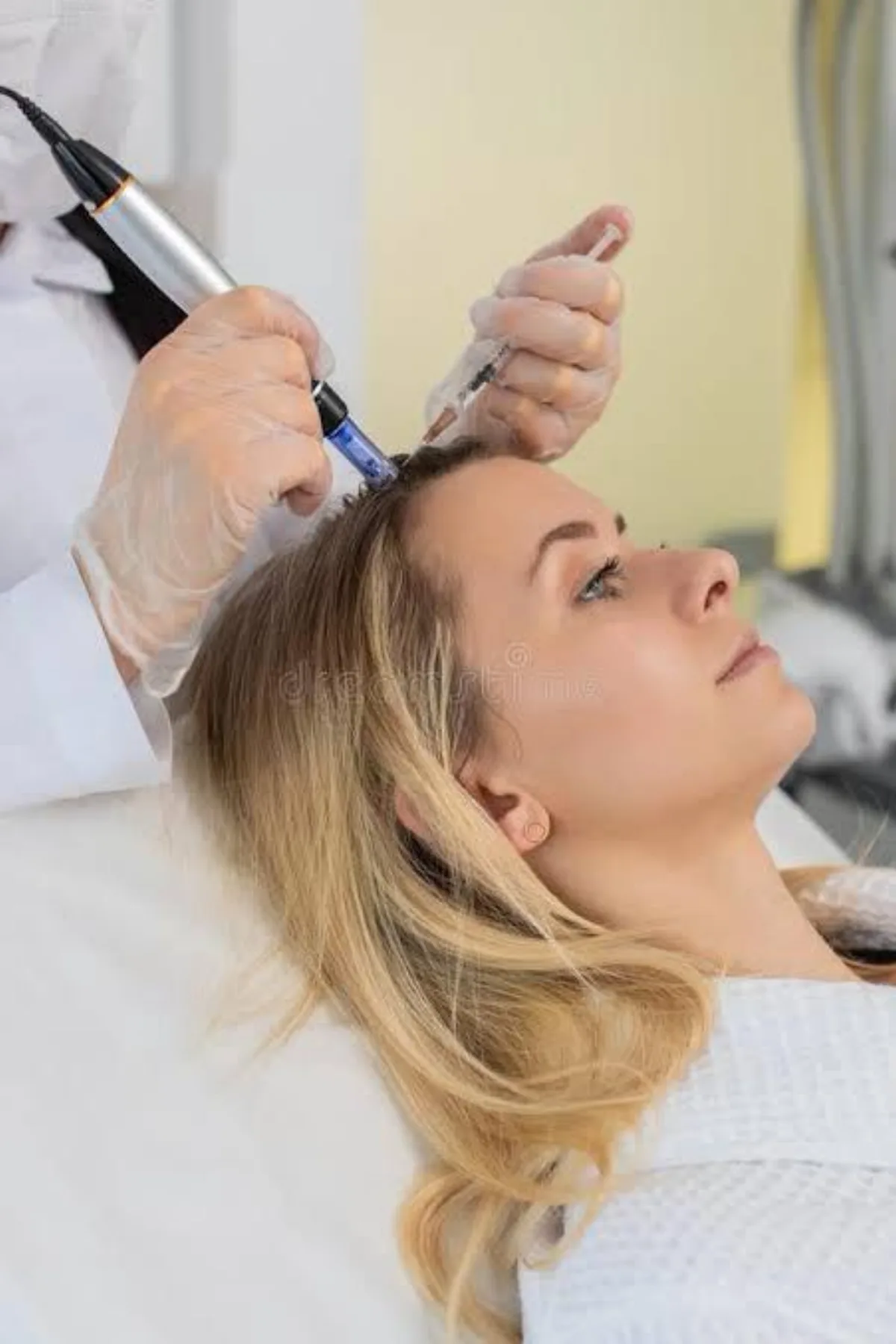 Microneedling Cheveux